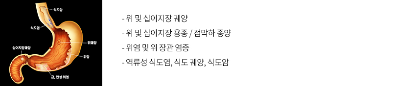 위 내시경으로 진단할 수 있는 질환