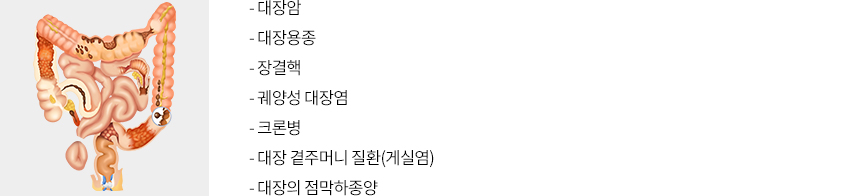 대장 내시경으로 진단할 수 있는 질환